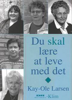 Du skal lære at leve med det