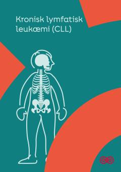 Kronisk lymfatisk leukæmi (CLL)
