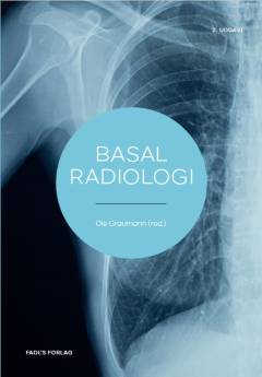 Basal radiologi