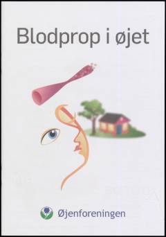 Blodprop i øjet