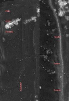 Tænder, hofter, hænder