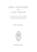 Bone metastases in lung cancer : a clinical study in 200 consecutive patients with bronchogenic carcinoma and its therapeutic implications for small cell carcinoma