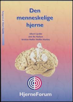 Den menneskelige hjerne