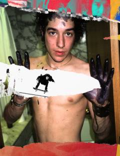 The scars of Ali Boulala