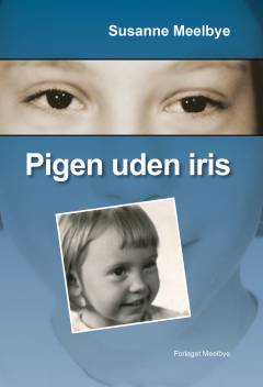 Pigen uden iris