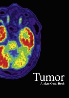 Tumor