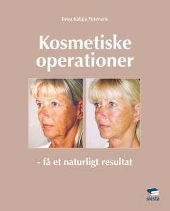 Kosmetiske operationer : få et naturligt resultat