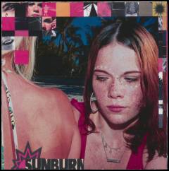 Sunburn