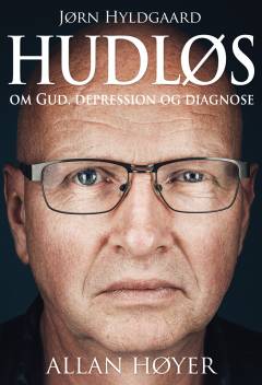 Hudløs : Jørn Hyldgaard - om Gud, depression og diagnose