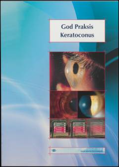 God praksis - keratoconus