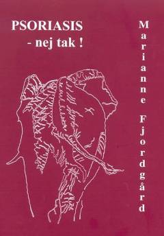 Psoriasis - nej tak!