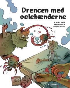 Drengen med øglehænderne : Carl har børneeksem