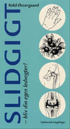 Slidgigt : bliv din egen ledvogter!