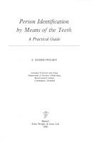 Person identification by means of the teeth : a practical guide