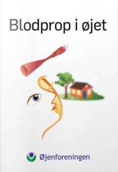 Blodprop i øjet