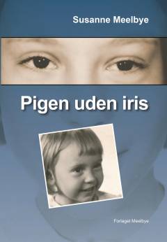 Pigen uden iris