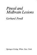 Pineal and midbrain lesions
