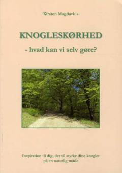 Knogleskørhed - hvad kan vi selv gøre?
